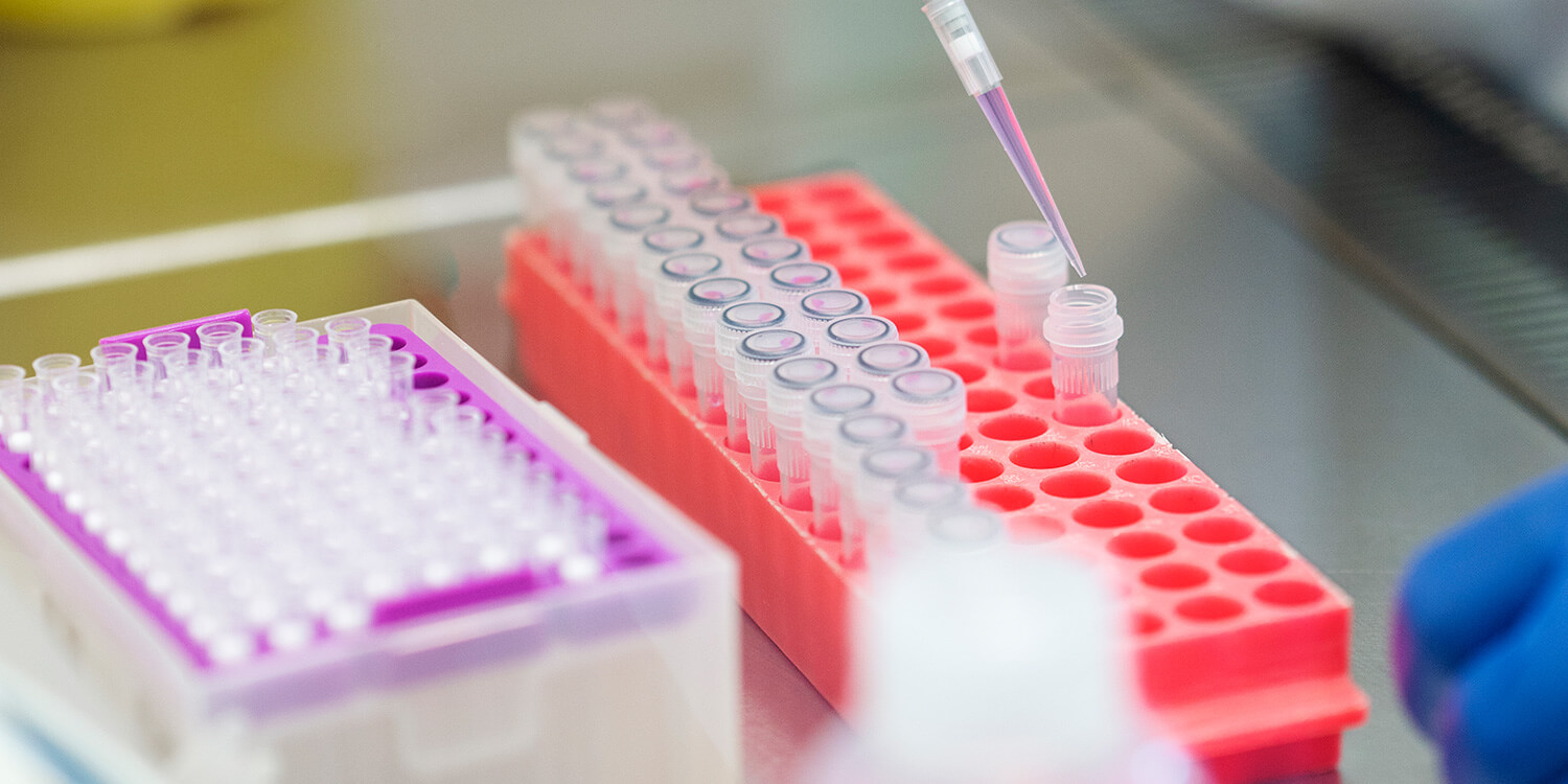 p RT-qPCR Pathogen Detection Kits 