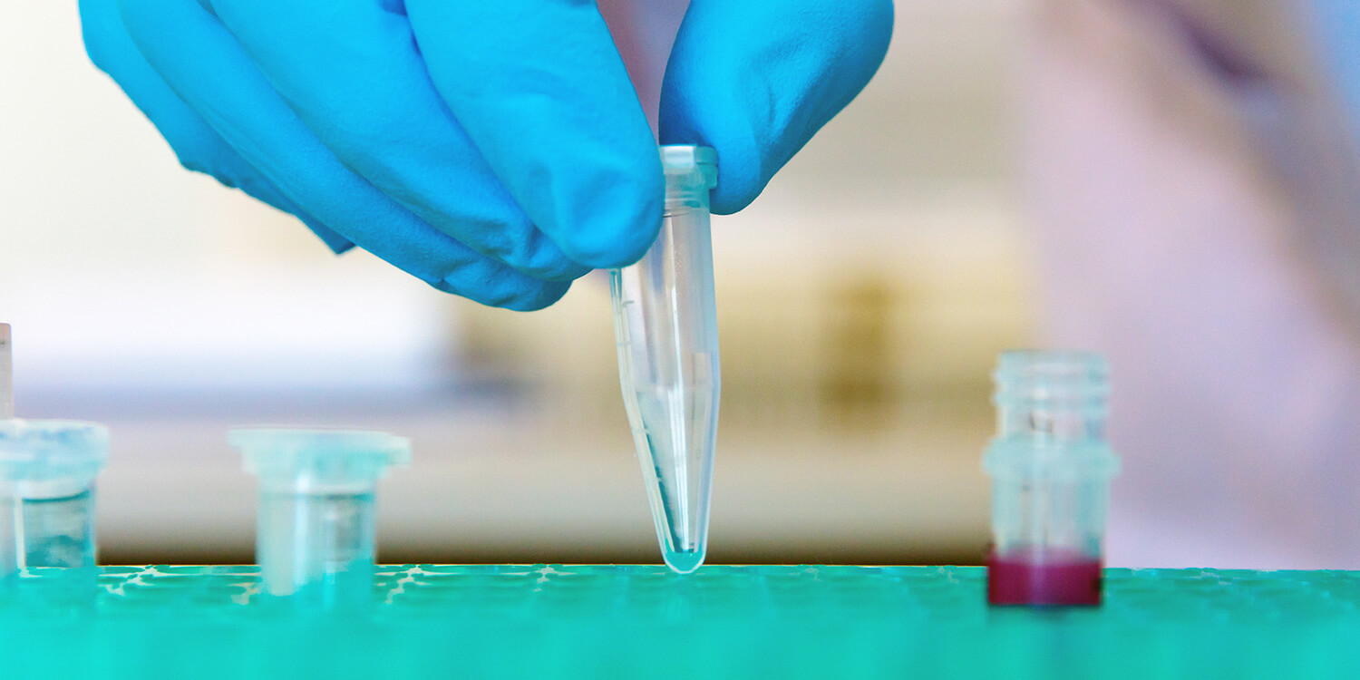 pAgarose Gel Electrophoresis Products